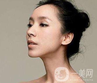 骨粉隆鼻后遺癥是什么樣的？