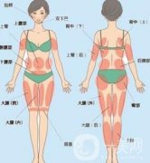 做個(gè)全身吸脂多少錢?