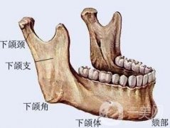 磨下頜角價格是不是很貴？一般要多少錢？
