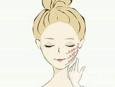 磨下頜角價(jià)格是不是很貴？一般要多少錢？