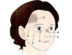 祛斑手術(shù)價格貴不貴？要多少錢？