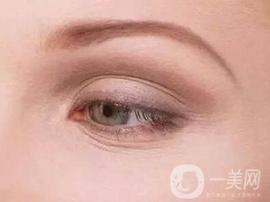 去除魚尾紋的方法有哪些？哪種方法比較好？