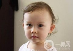 去頰脂墊價格貴嗎？大概價位是多少？