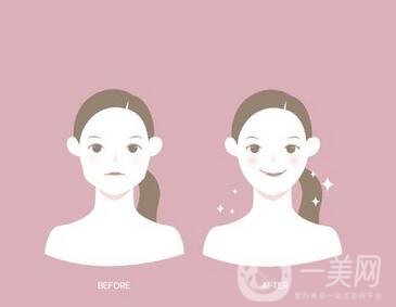去頰脂墊有副作用嗎？術(shù)后如何護(hù)理可以減小副作用？