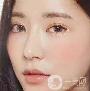 *需要拆線嗎？多長時(shí)間可以碰水？