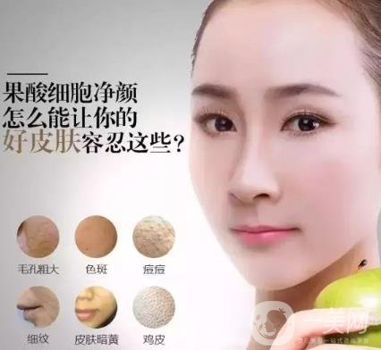 果酸換膚的作用是什么？功*是什么？