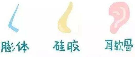 隆鼻手術(shù)