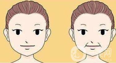 冰電波拉皮除皺*果如何？有哪些優(yōu)點(diǎn)？