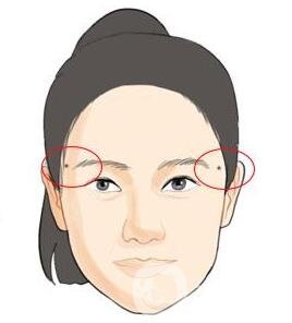 點(diǎn)痣后注意事項(xiàng)一定要遵守，否則會(huì)留疤！