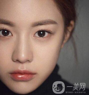 如何讓鼻梁變高？可以注射玻尿酸嗎？