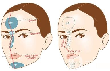 如何讓鼻梁變高？可以注射玻尿酸嗎？