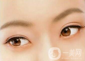 三點(diǎn)定位雙眼皮手術(shù)后應(yīng)該注意些什么？
