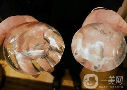 胸部整形術(shù)要多少錢?大概價位說明