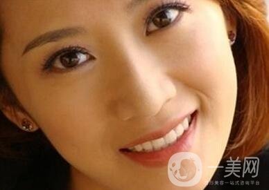 墊個(gè)鼻子要多少錢？大概價(jià)位是多少？
