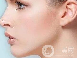 墊個(gè)鼻子要多少錢？大概價(jià)位是多少？