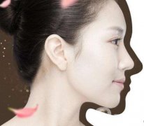 韓式立體隆鼻術(shù)的果怎么樣？