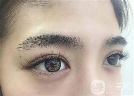 如何減少眼部皺紋？哪些方法比較*？