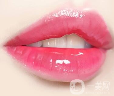 豐唇手術(shù)價(jià)格貴不貴？要多少錢(qián)？
