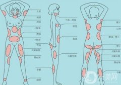 全身抽脂減肥多少錢？貴嗎？