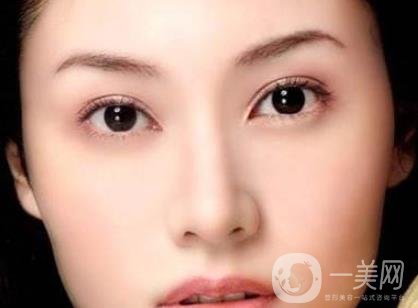 吸雕雙眼皮手術(shù)是什么？是埋線嗎？