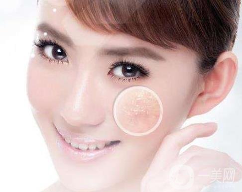 像素激光去痘的*果好嗎？會反彈嗎？