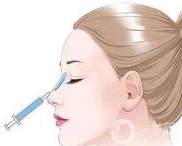 瑞蘭玻尿酸注射除皺*果怎么樣？