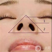 鼻頭縮小手術(shù)價錢大概是多少？