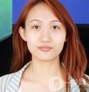 長沙微恩醫(yī)療整形醫(yī)院價格表，附隆鼻真實恢復案例