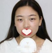 西南醫(yī)院整形美容外科價格表，附雙眼皮手術果一覽
