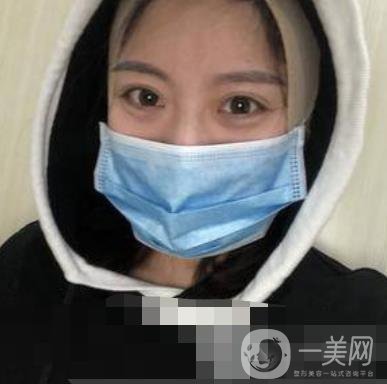 河北省人民醫(yī)院整形外科價(jià)格表新版來(lái)襲，附去下頜骨案例