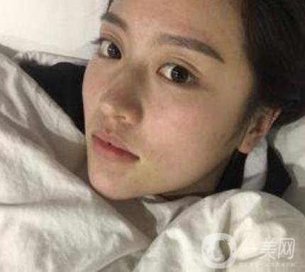 河北省人民醫(yī)院整形外科價(jià)格表新版來(lái)襲，附去下頜骨案例