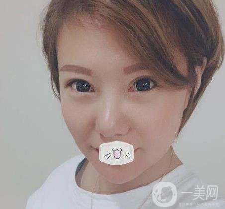 綿陽中心醫(yī)院整形美容科價格表2020發(fā)布，附祛眼袋案例