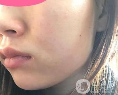 寧波第一醫(yī)院整形科價(jià)格表收費(fèi)明細(xì)上線，看打玻尿酸真人案例