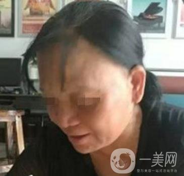 廣東省人民醫(yī)院整形科價格表，附祛斑整形日記