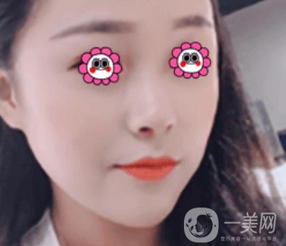 岳陽市第一人民醫(yī)院整形美容科祛斑好嗎？價(jià)格表和案例日記分享