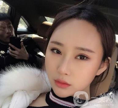 河北省中醫(yī)院整形美容科隆鼻怎么樣？?jī)r(jià)格表及術(shù)后恢復(fù)日記分享