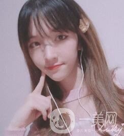 南昌二附院整形科價(jià)格表2020，附肋軟骨隆鼻整形案例