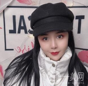 景德鎮(zhèn)第一人民醫(yī)院整形科價(jià)格表，附面部吸脂瘦臉案例