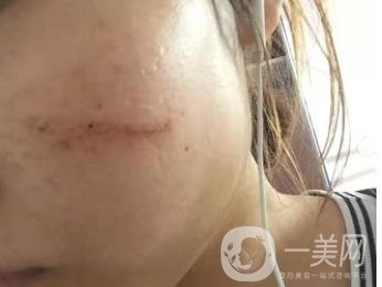 西安市中心醫(yī)院整形科價(jià)目?jī)r(jià)格一覽，附陶諫祛疤案例*果圖
