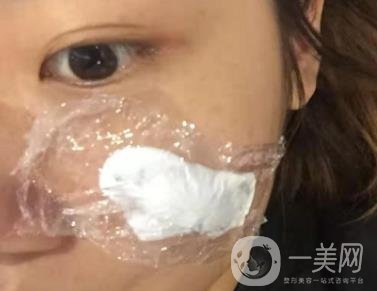 西安市中心醫(yī)院整形科價(jià)目?jī)r(jià)格一覽，附陶諫祛疤案例*果圖