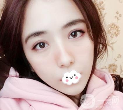 上海伯思立整形怎么樣？附沈國(guó)雄隆鼻案例及整形價(jià)格表
