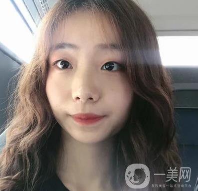 上海華美李志海磨骨多少錢？案例有嗎？整形價(jià)格表一覽