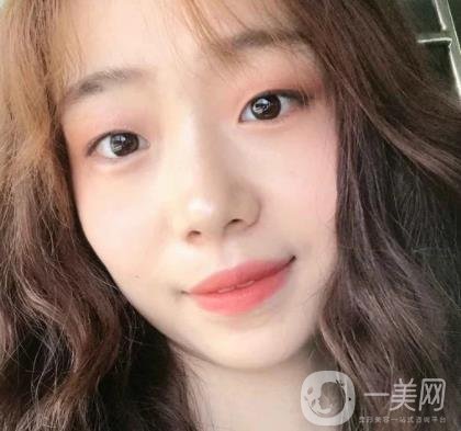 上海華美李志海磨骨多少錢？案例有嗎？整形價(jià)格表一覽