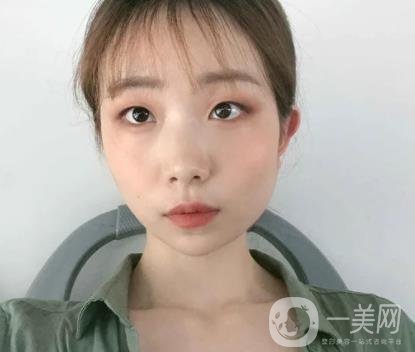 上海華美李志海磨骨多少錢？案例有嗎？整形價(jià)格表一覽