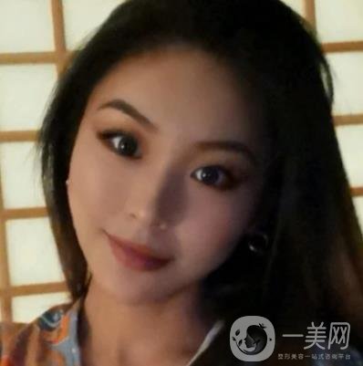 上海九院切下頜角手術(shù)經(jīng)歷分享，附2020整形價(jià)格一覽表