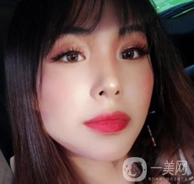 上海九院切下頜角手術(shù)經(jīng)歷分享，附2020整形價(jià)格一覽表
