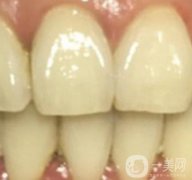 滿莊鎮(zhèn)衛(wèi)生院整牙好嗎？牙齒矯正價格在線一覽