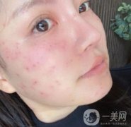 大連醫(yī)院美容科價格表及*術(shù)后果一覽