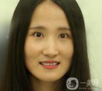 北京市海淀醫(yī)院整牙多少錢？看價格表及案例果
