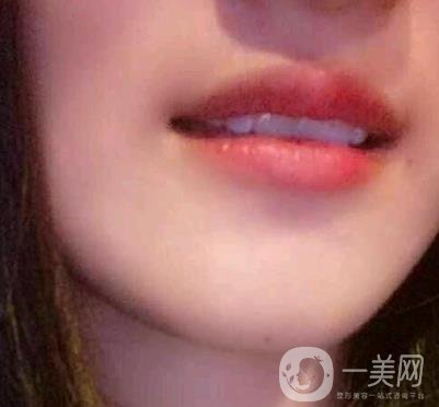 北京市海淀醫(yī)院整牙多少錢？看價格表及案例*果